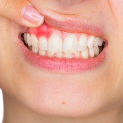 periodontoloji